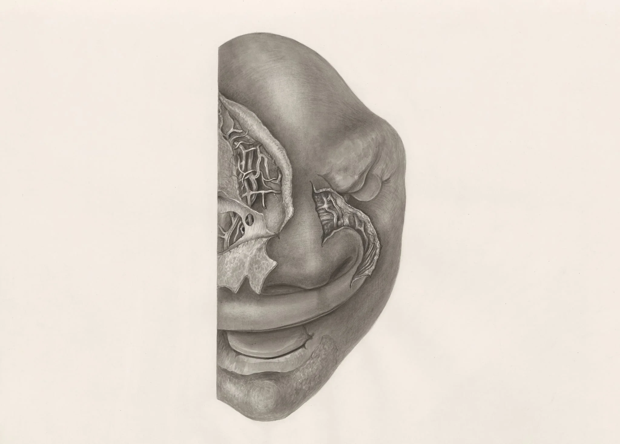 Deformed fetal head, partly seen from the front, by H.G, Wetselaar, 1970