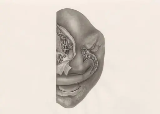 Deformed fetal head, partly seen from the front