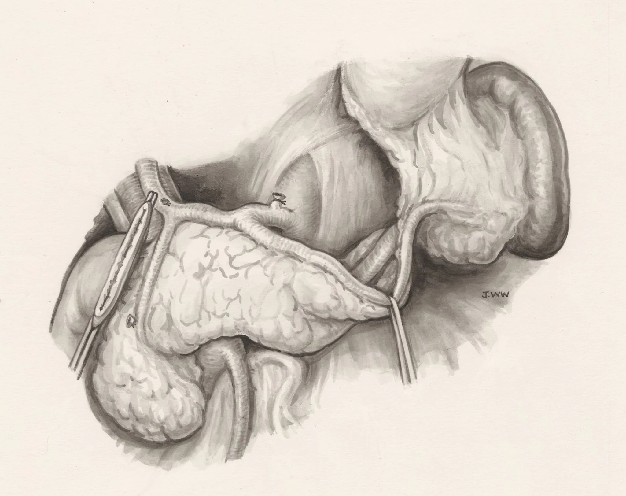 Operation on human tissue, by J Wetselaar-Whittaker, 1989