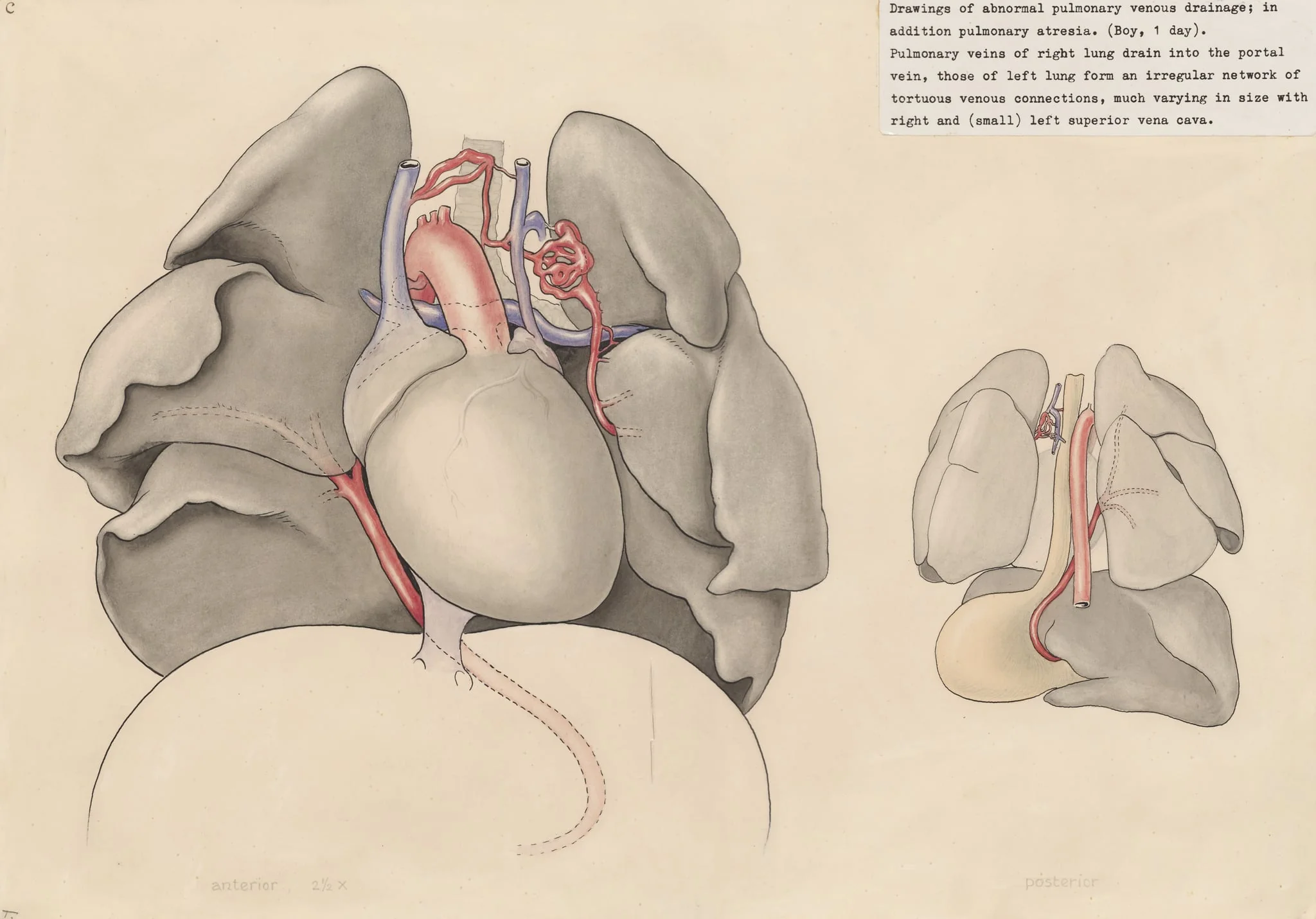 Heart and adjacent organs, by J Tinkelenberg, unspecified, 1970