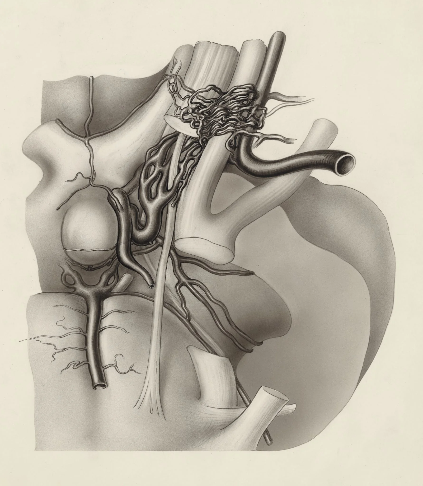 Nerves and other tissue of the neck and/or head, by J Tinkelenberg, 1963