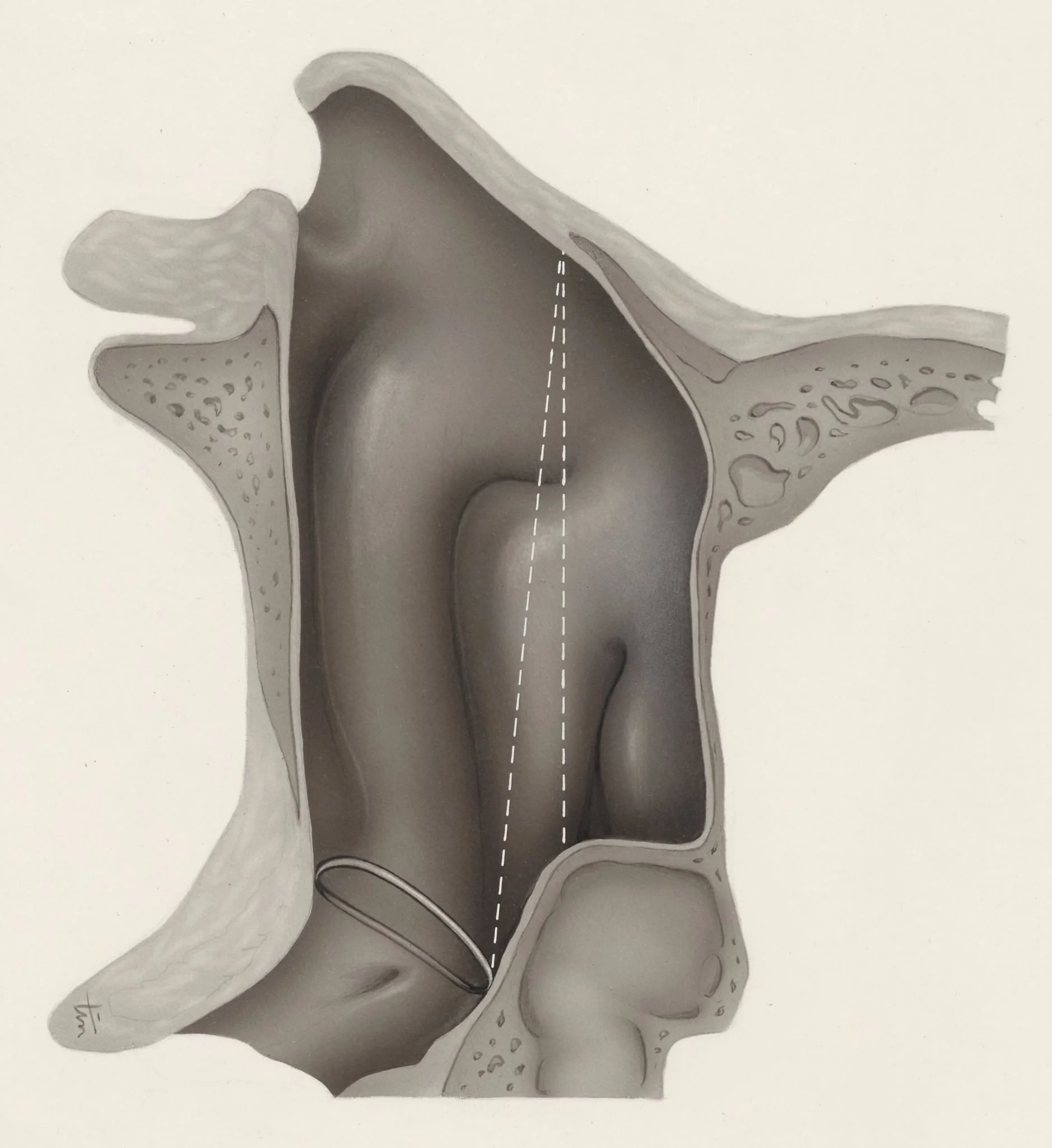 Respiratory system, by J Tinkelenberg, unspecified, 1970