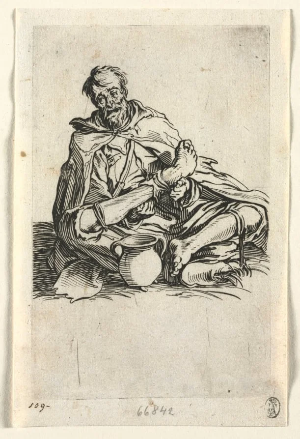 The Beggars: Malingerer, by Jacques Callot, 1623