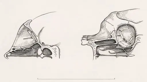 Cross section of the palate and/or nasal cavity of a human and a mammal