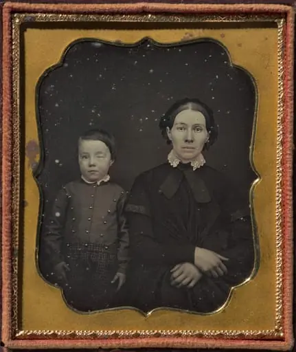 Mother with son with blind right eye