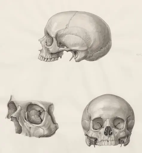 Skull seen from three sides