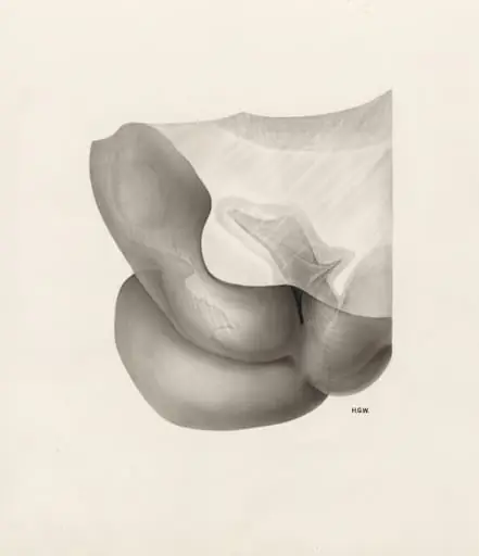 Embryonic tissue