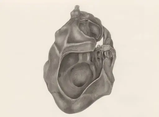Deformed skull, seen from below