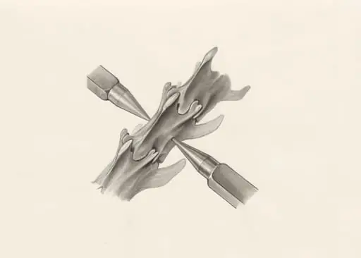 Vertebrae between medical equipment