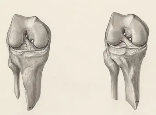 Muscular tissue of a joint