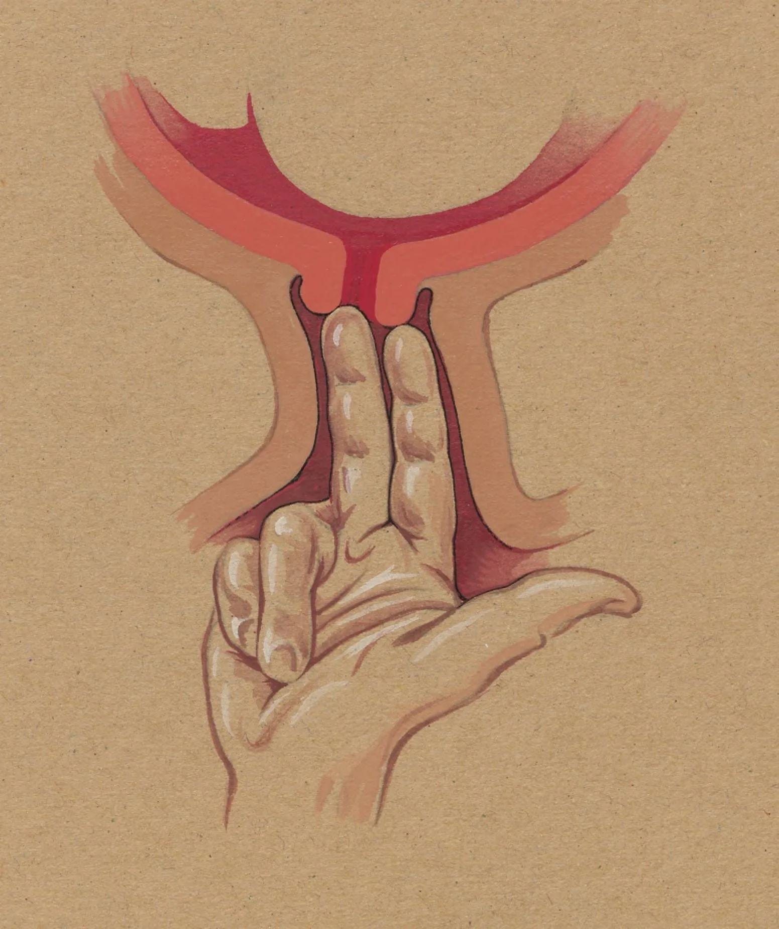 gynaecological procedure, two fingers penetrating the cervix, by J Tinkelenberg, unspecified, 1977