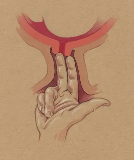 gynaecological procedure, two fingers penetrating the cervix