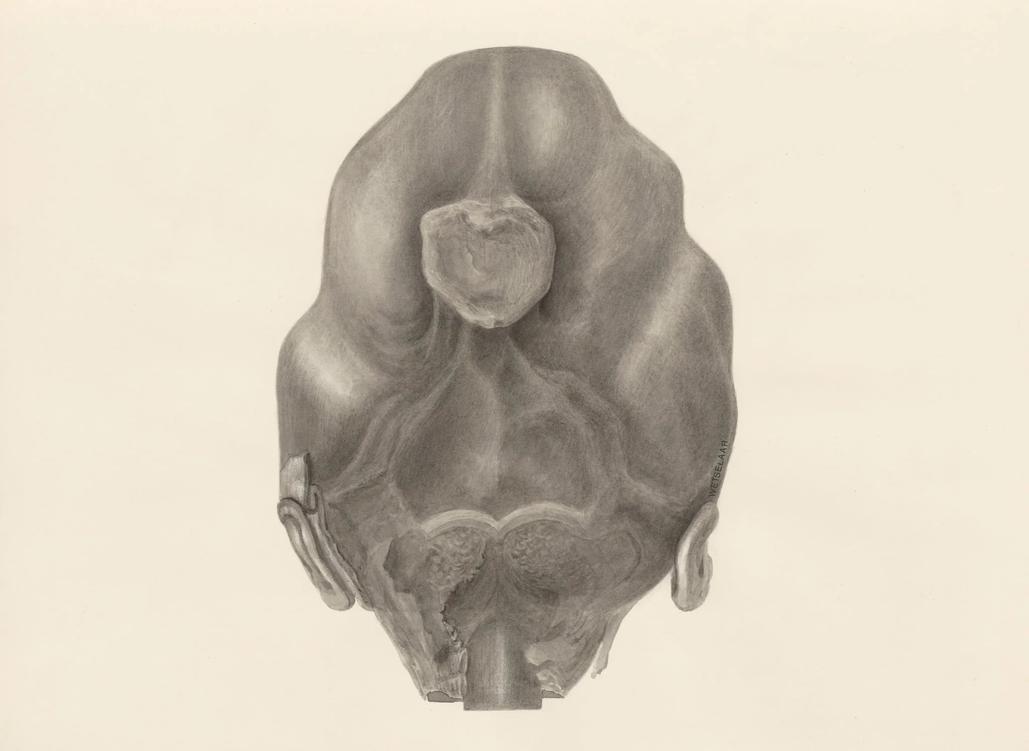 Deformed fetal head, seen from the back