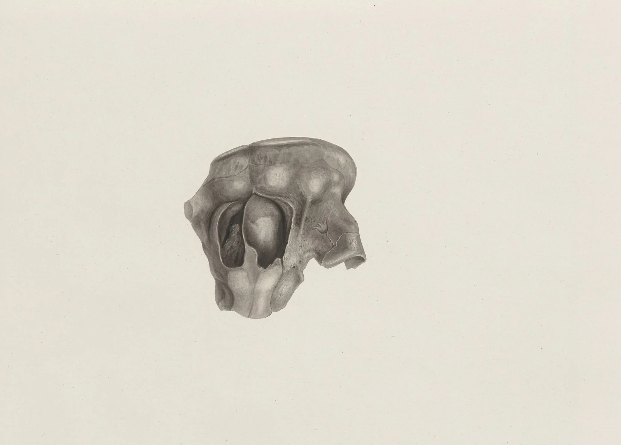 Part of a deformed fetal head