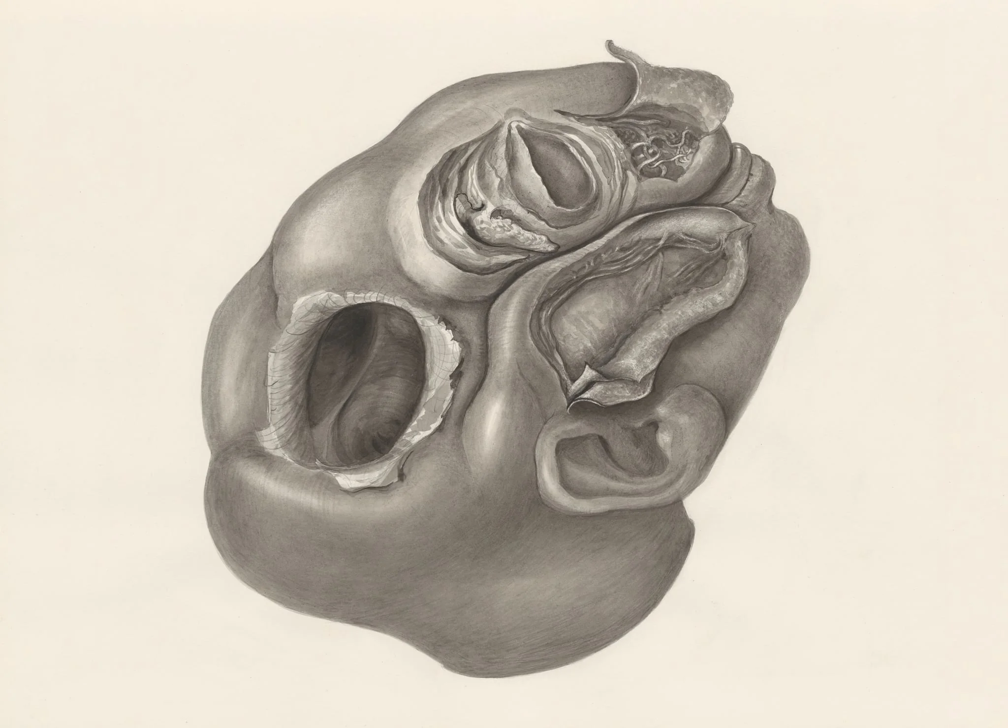 Deformed fetal head, lateral view