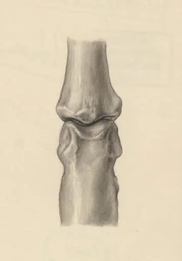 Joints of the hand or fingers