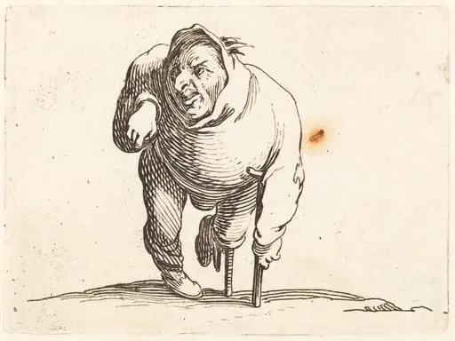 Cripple with Crutch and Wooden Leg