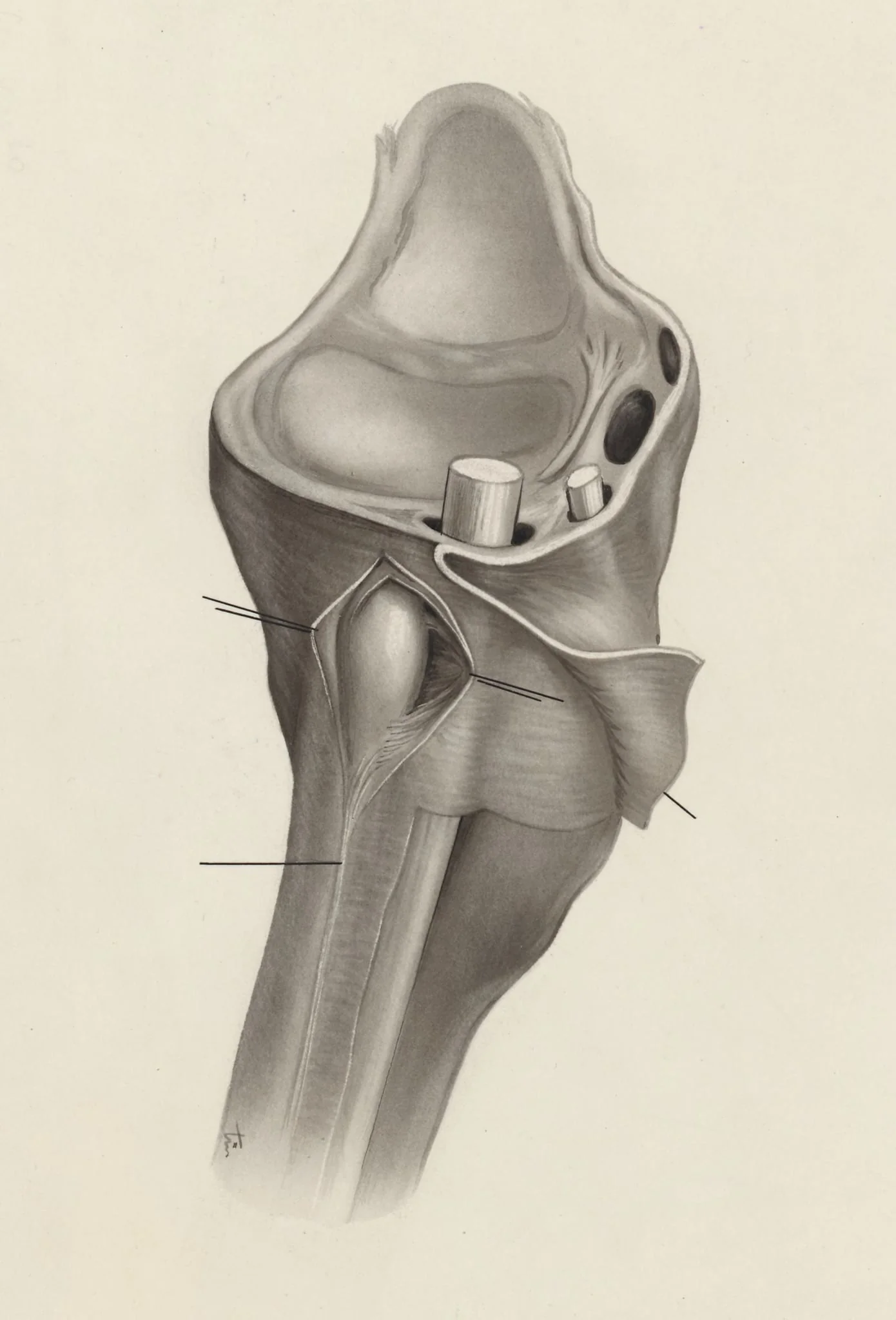 Musculoskeletal system of the wrist, by J Tinkelenberg, 1970