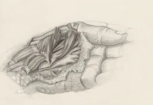 Musculoskeletal system of the upper extremity