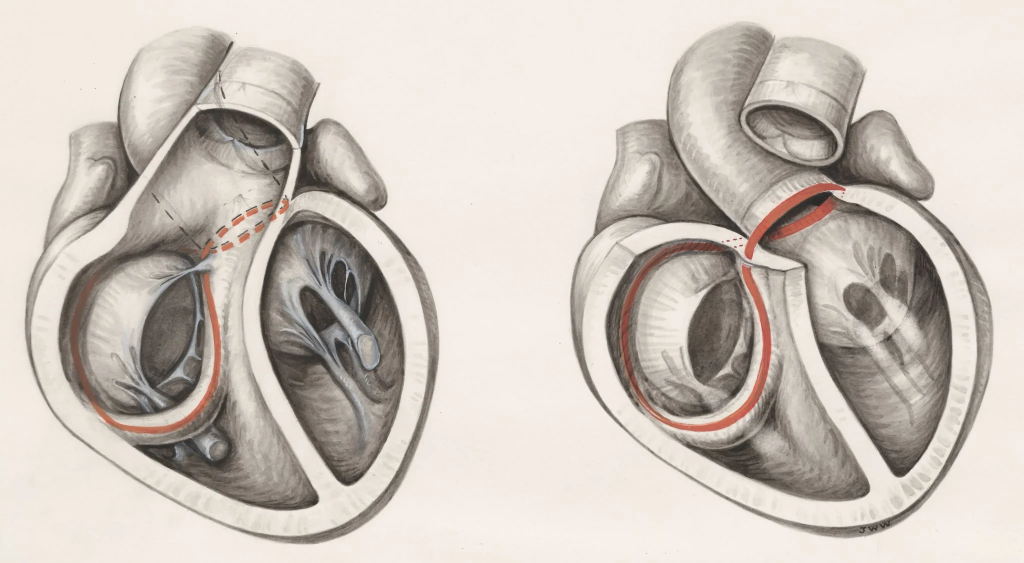 Two cross sections of the human heart, by J Wetselaar-Whittaker, unspecified, 1970