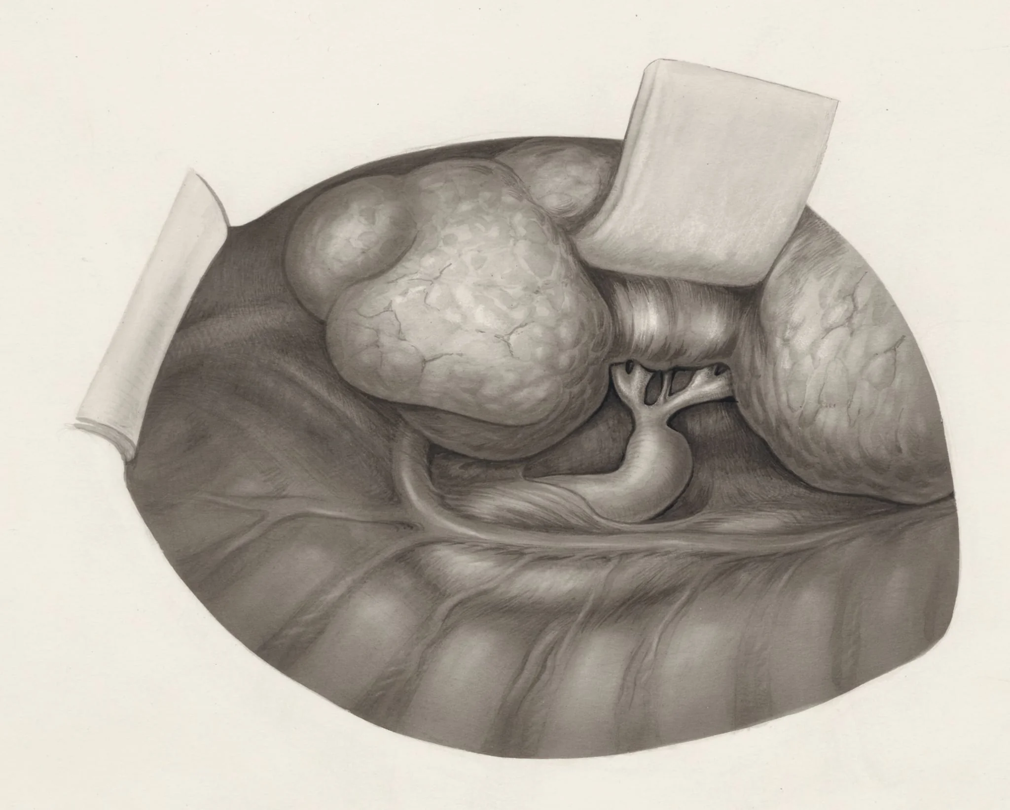Human organs, by H.G, Wetselaar, 1970