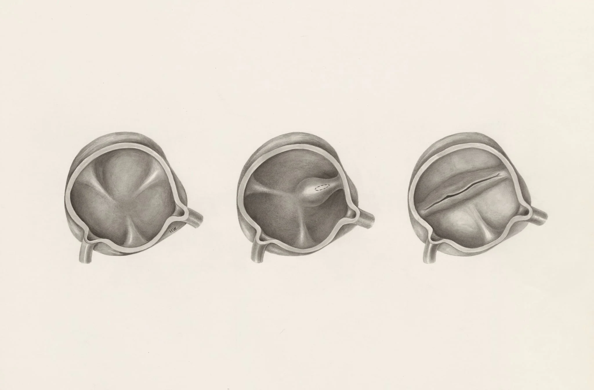 Cross section of the cardiovascular system, by H.G, Wetselaar, 1971