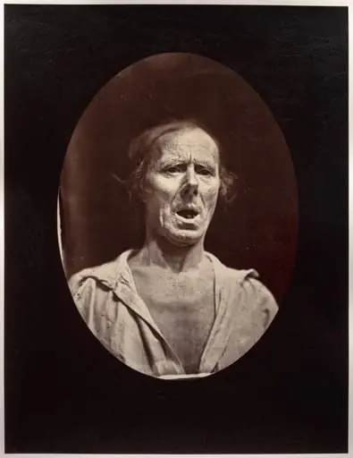 Figure 54: Abaissement volontaire de la mâchoire inférieure: mouvement inexpressif
