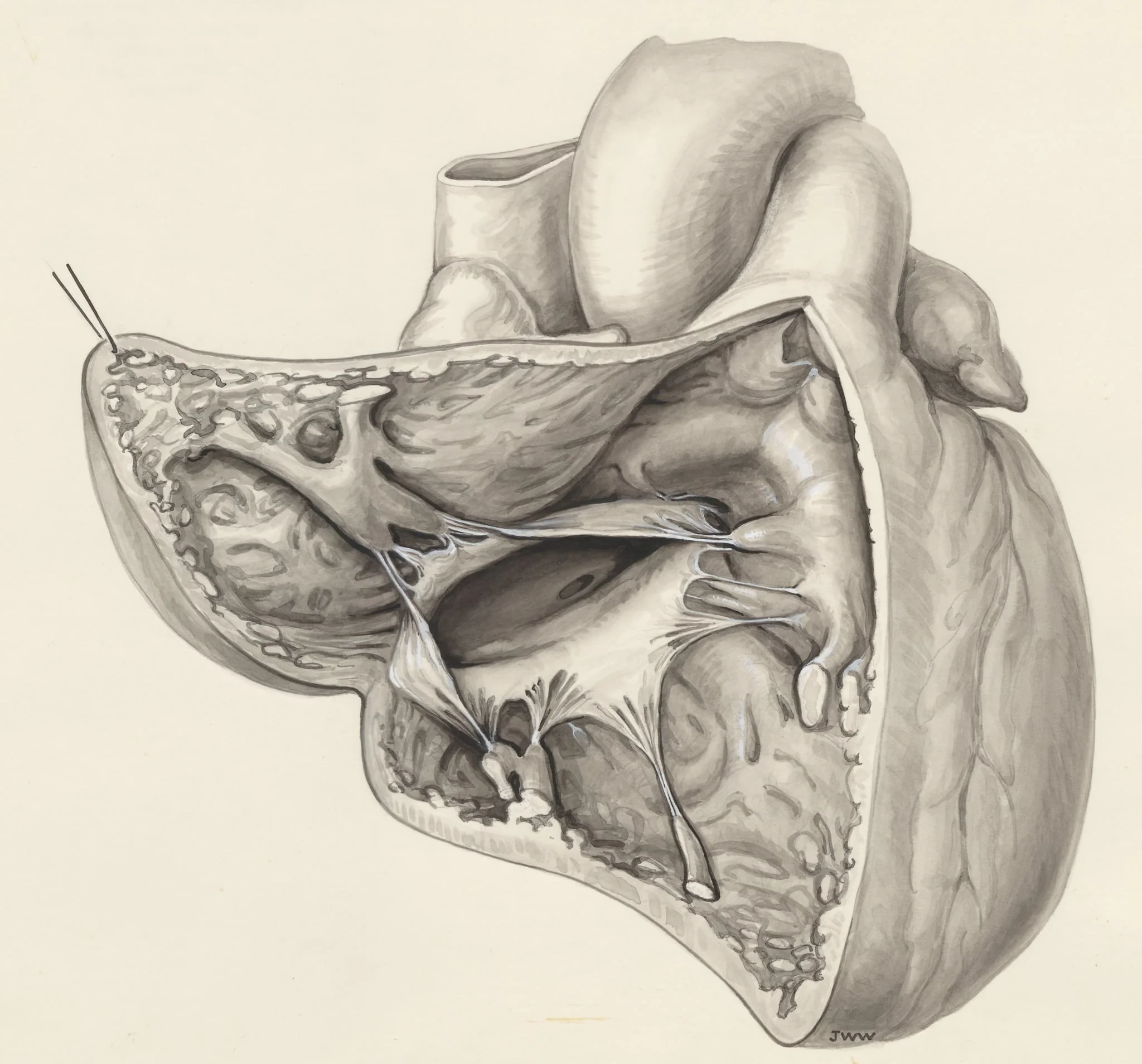 Heart