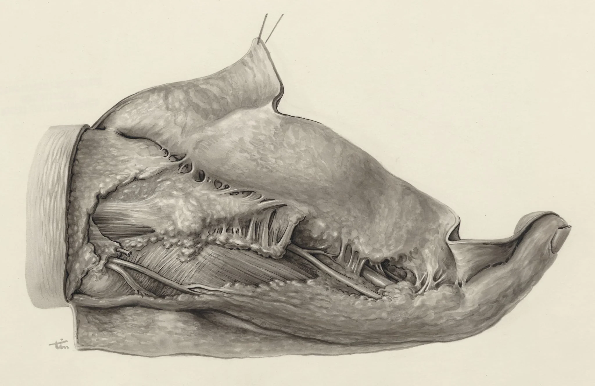 Muscular tissue of the hand and finger