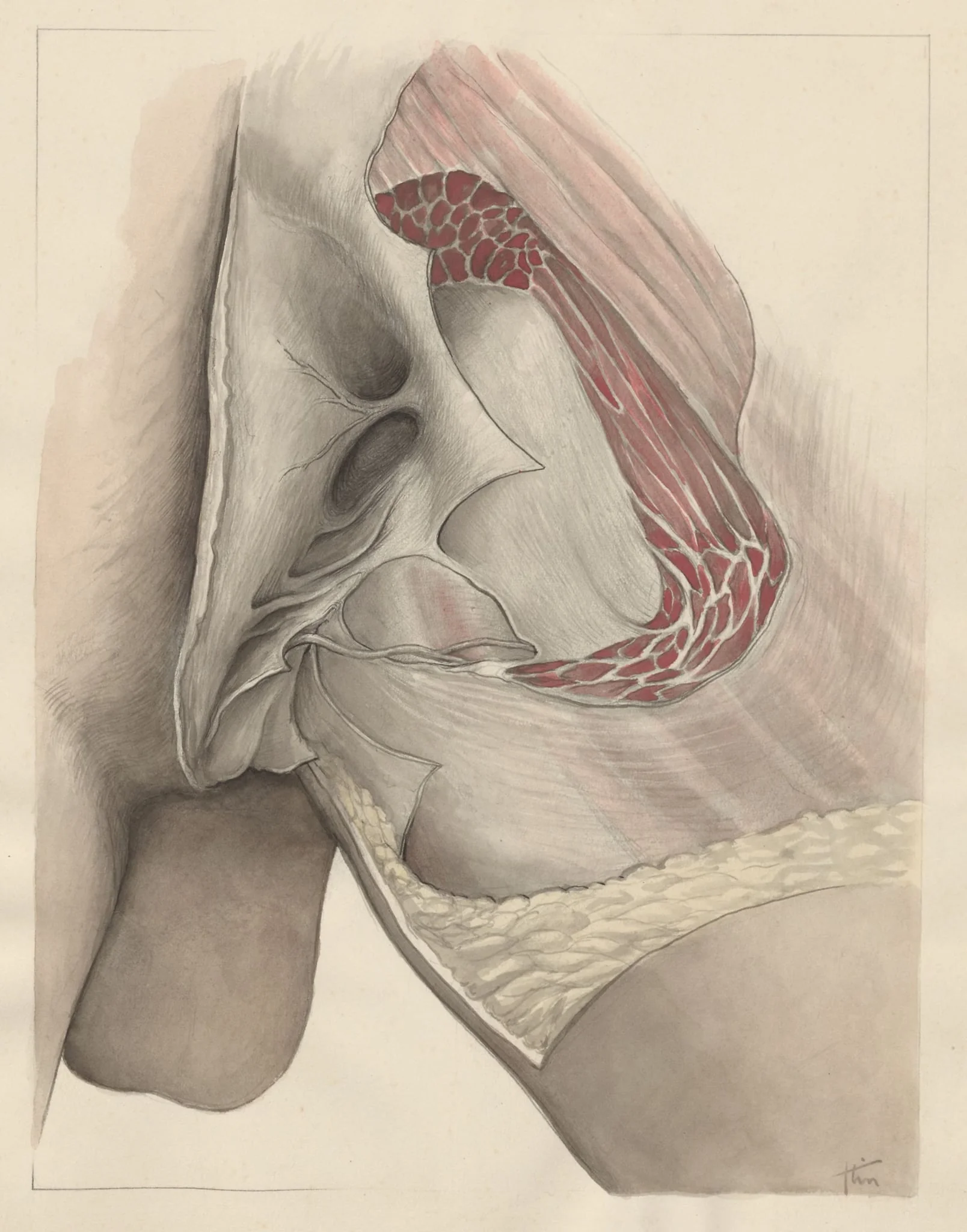 Tissue of the buttocks, by J Tinkelenberg, unspecified, 1970